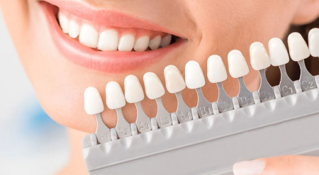 Emax Lamina / Veneer (Yaprak Porselen) Nedir?