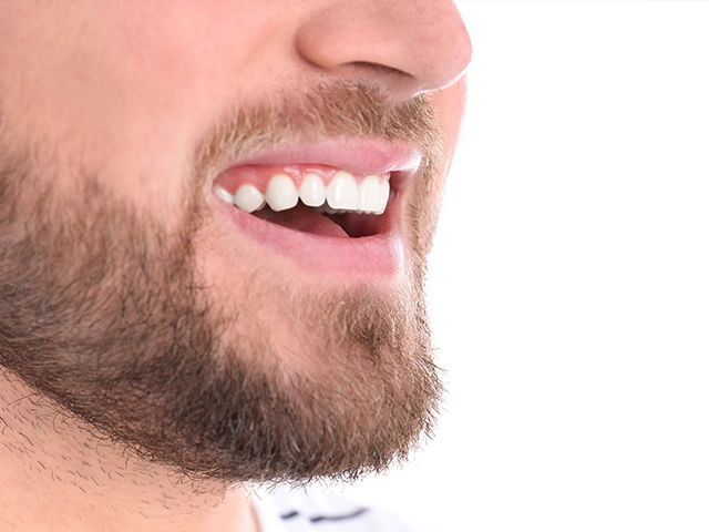 Zirkonyum Kaplama Diş Modelleri Erkek