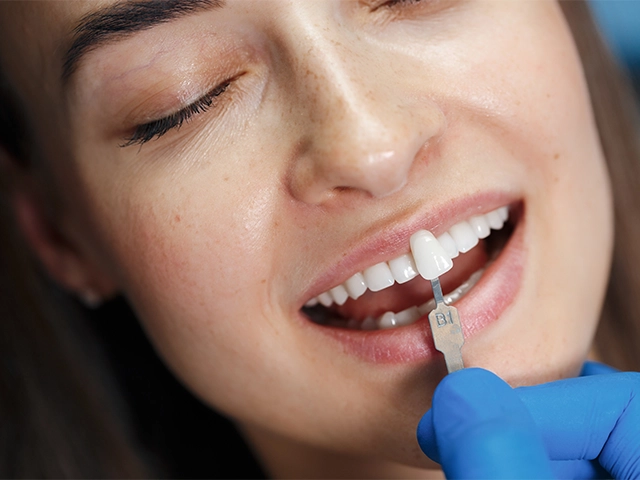 Zirkonym Kaplama Dis Nasil Cikarilir