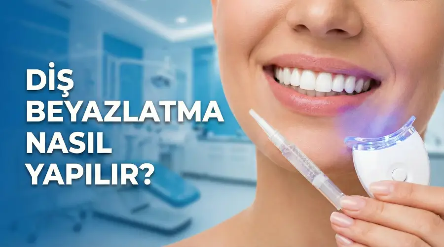 Diş beyaztlatma işlemleri