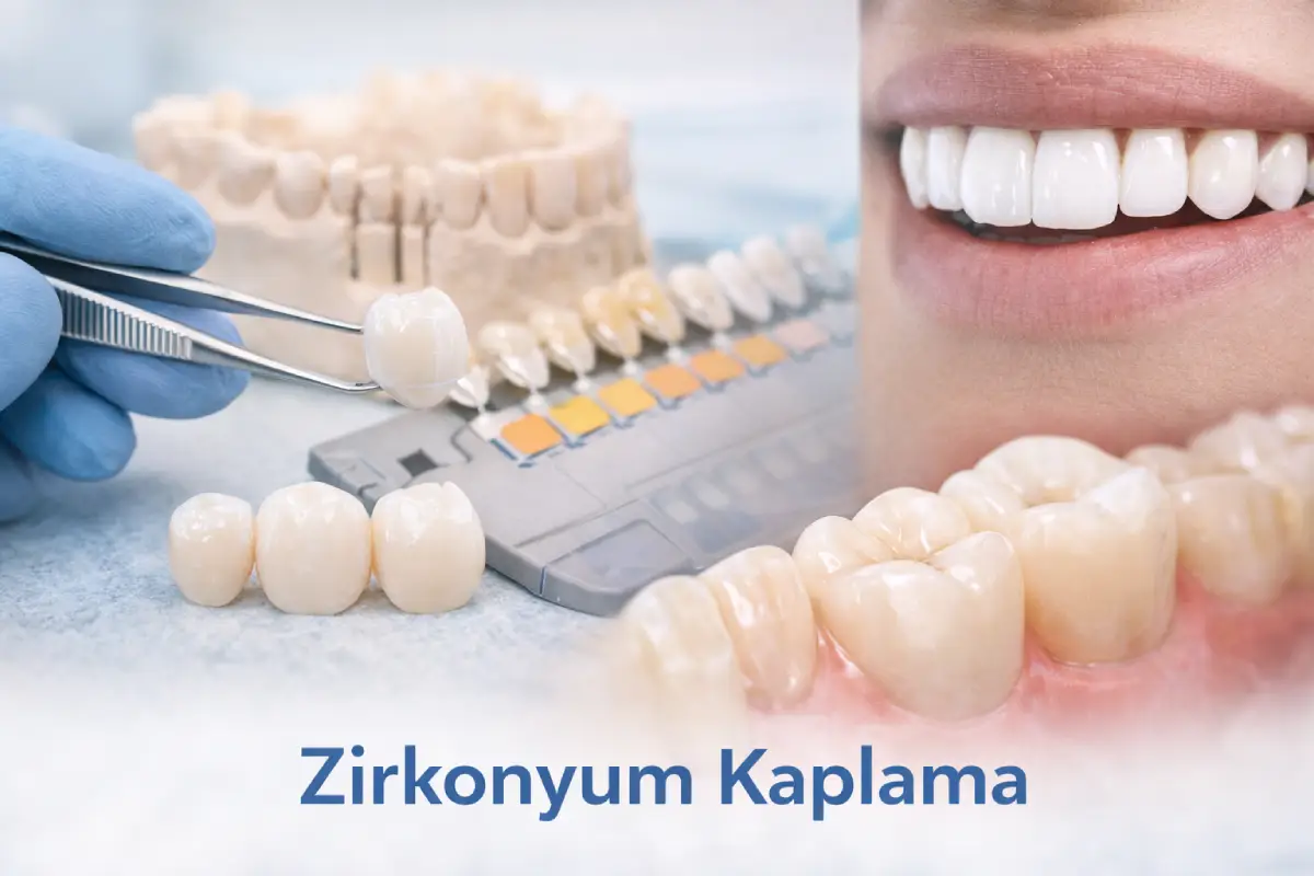 Zirkonyum Kaplama İşlemi