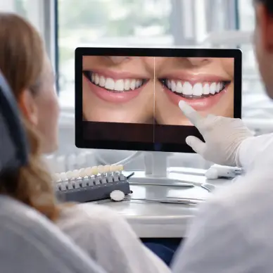 gülüş tasarımı işlemleri