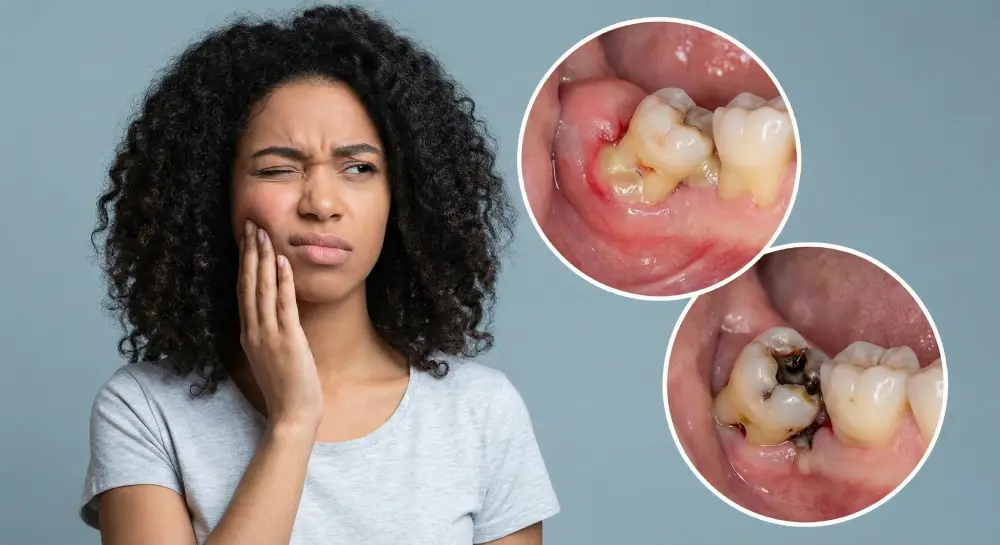 20 lik Diş Ağrısı