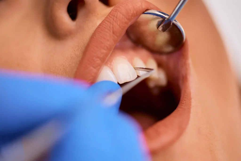 ağız yarası neden olur