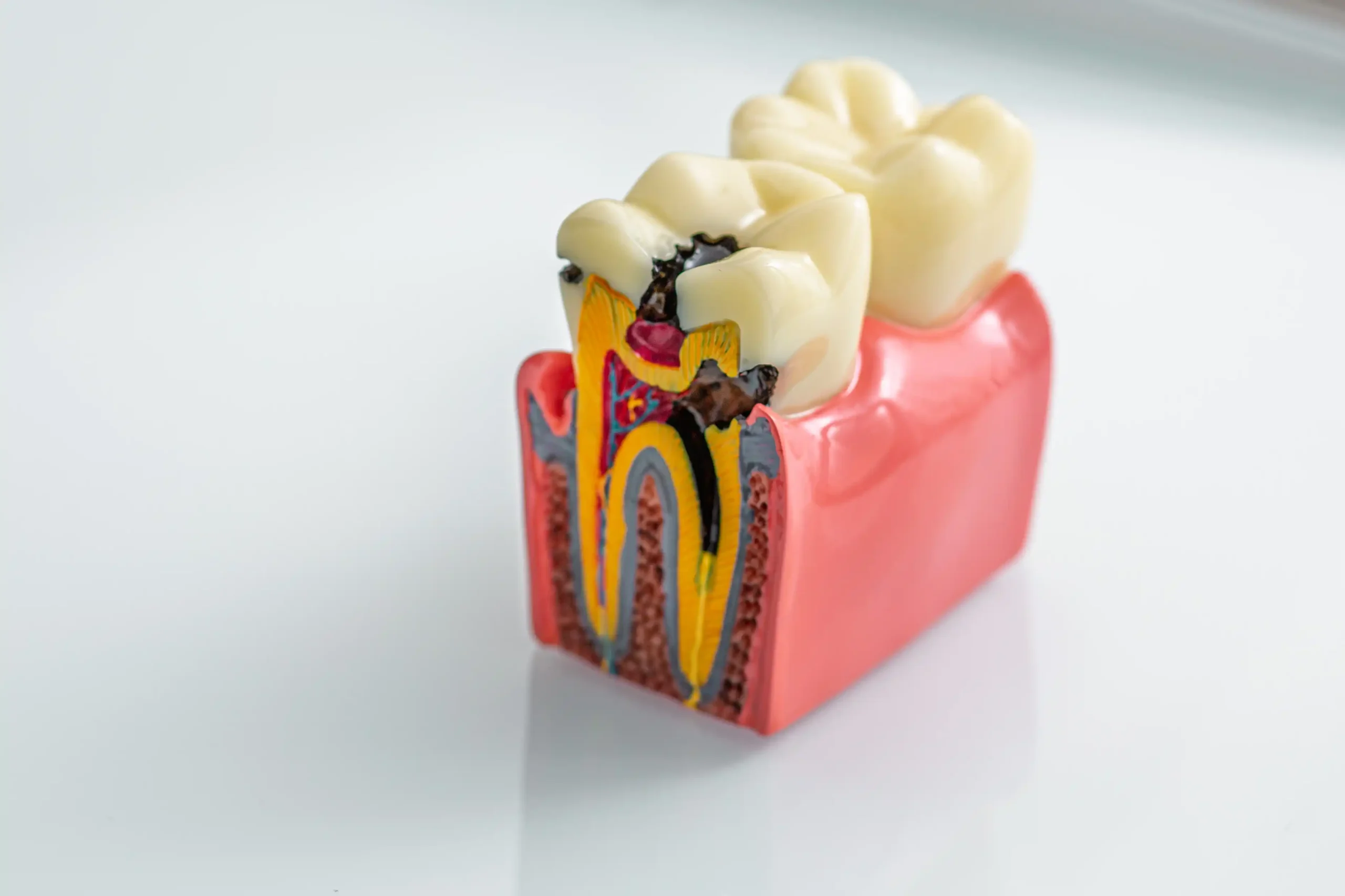 Alveolit Nedir?
